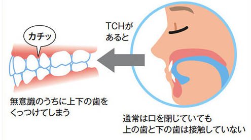 かほく市の歯医者、しん義歯科口腔外科で、顎関節症の治療